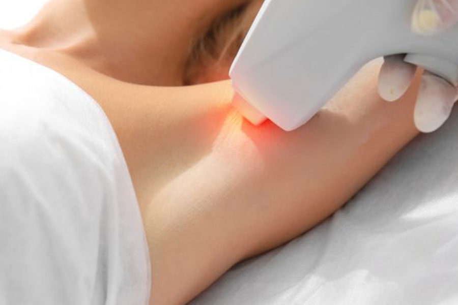 Depilazione laser: le domande più frequenti