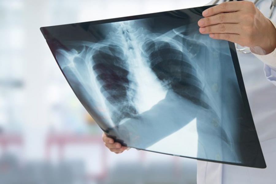 Radiologia domiciliare: un business in continua espansione